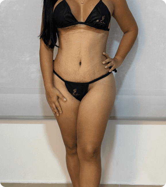 Image hover effect image