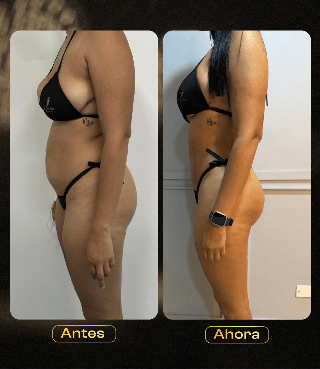 Image hover effect image