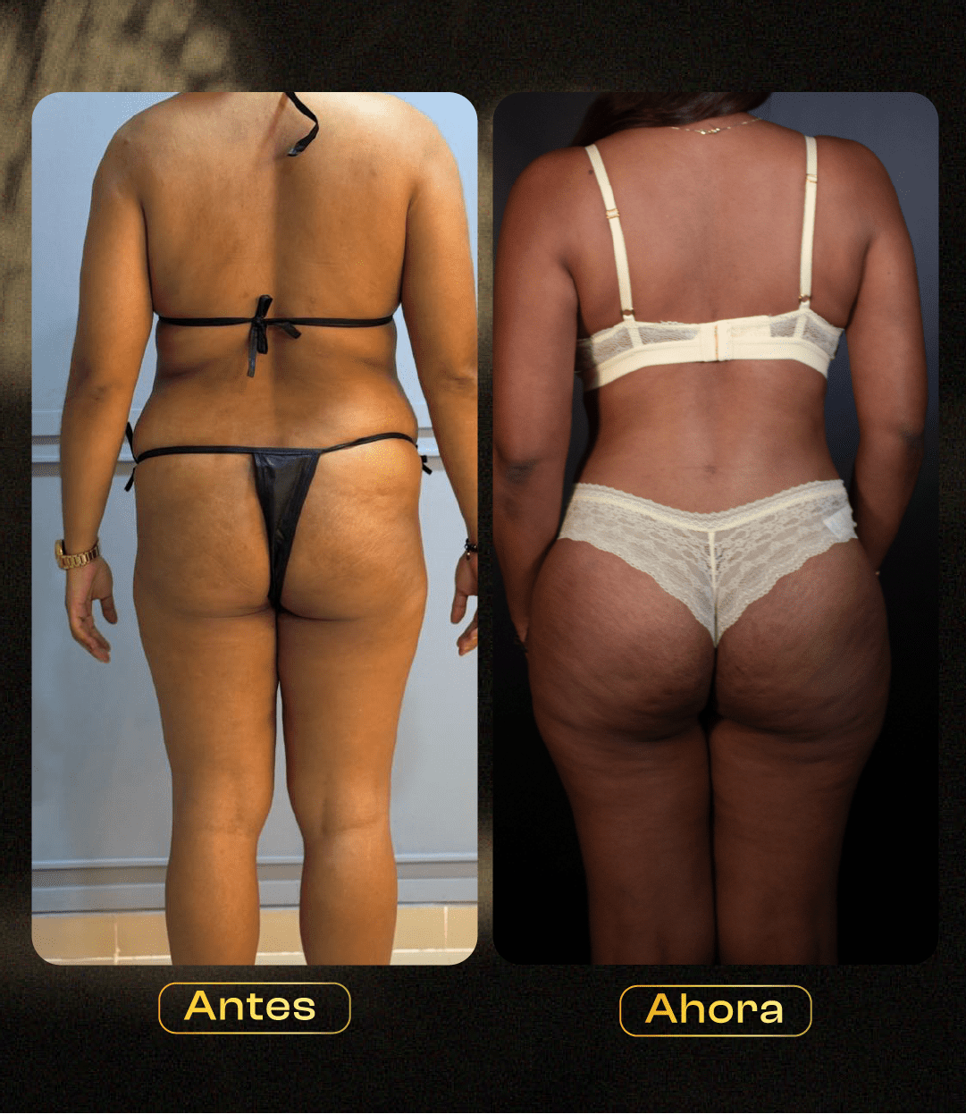 Image hover effect image