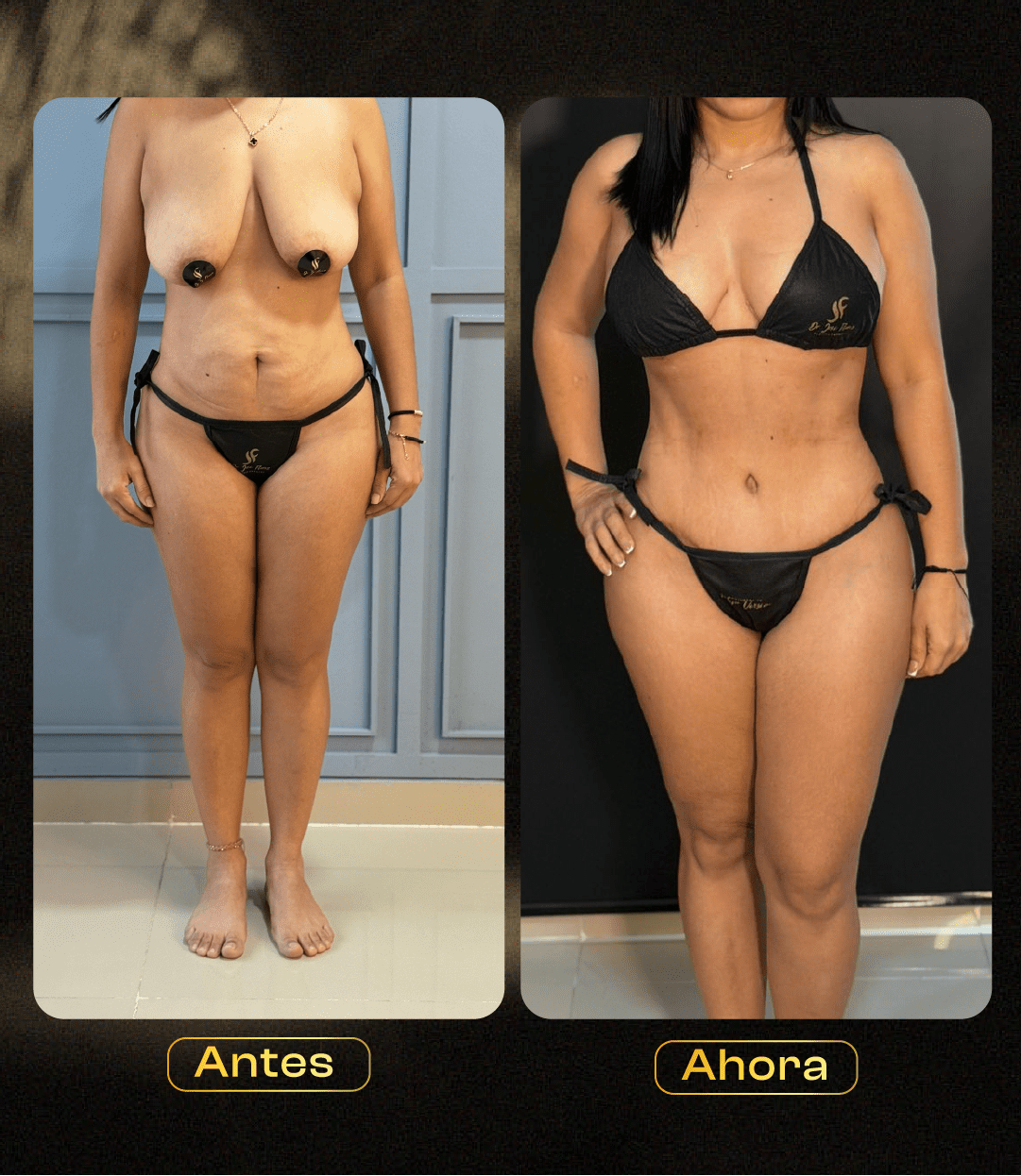 Image hover effect image