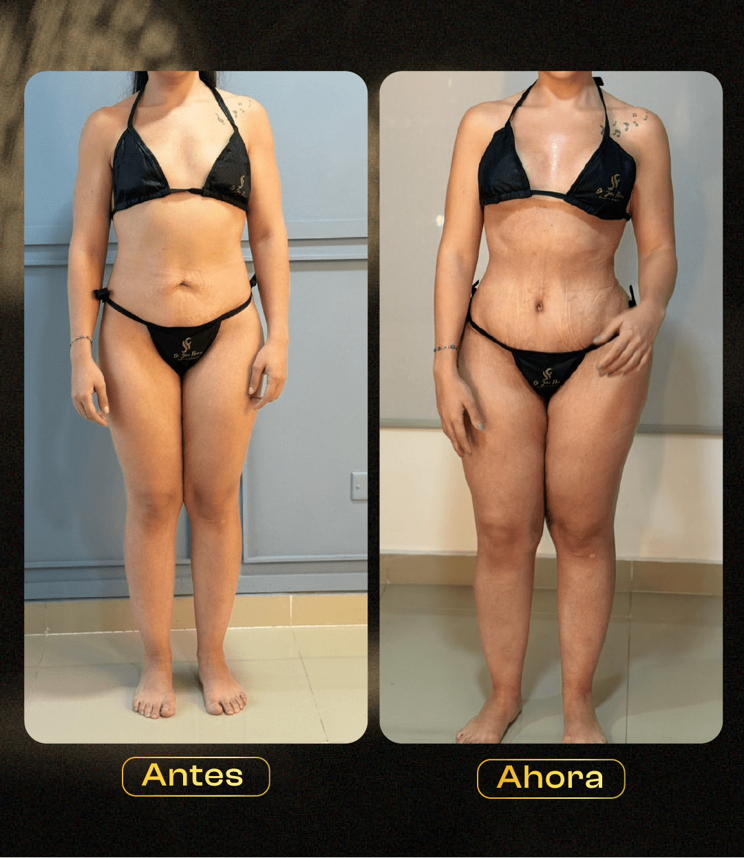 Image hover effect image