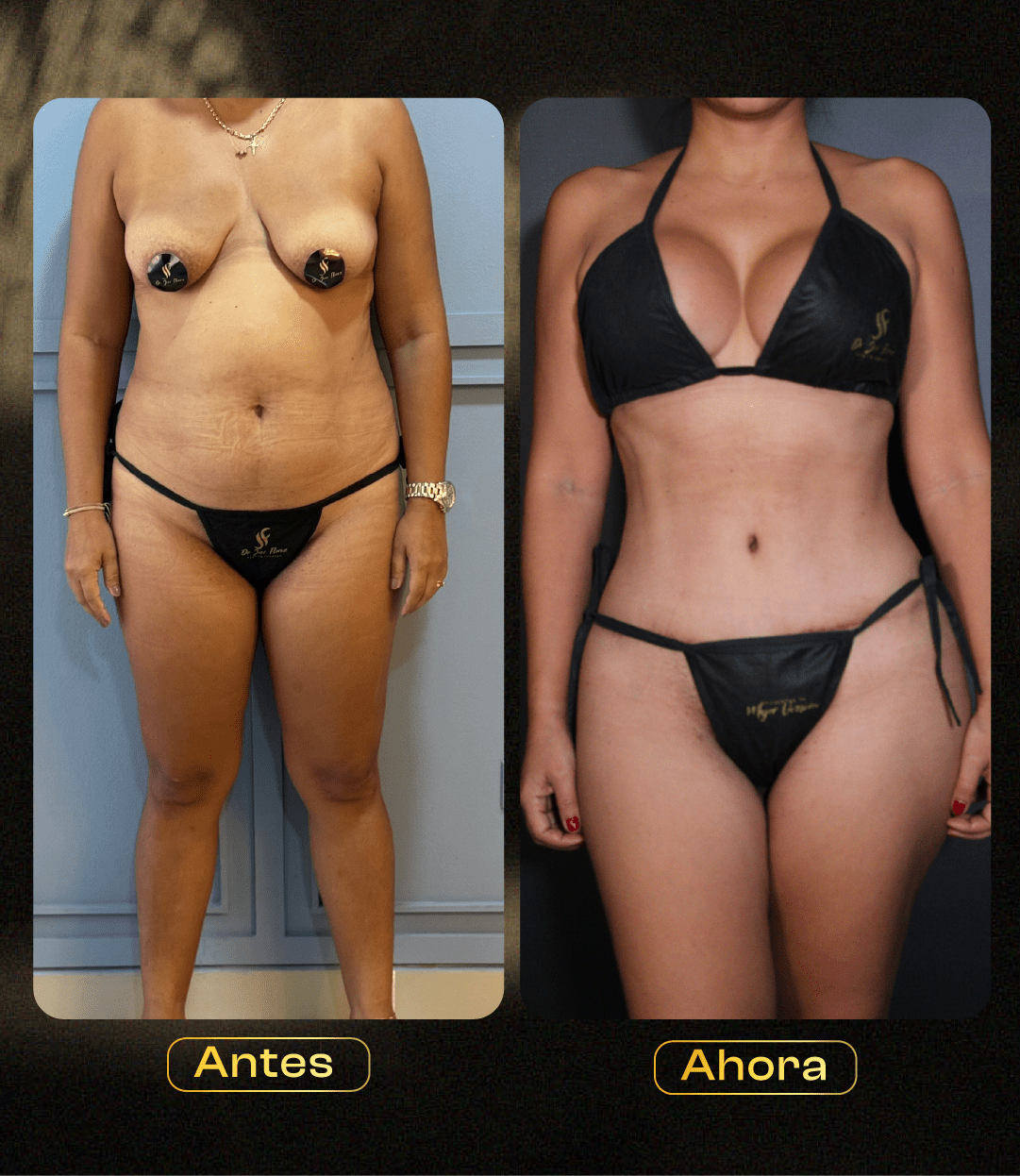 Image hover effect image