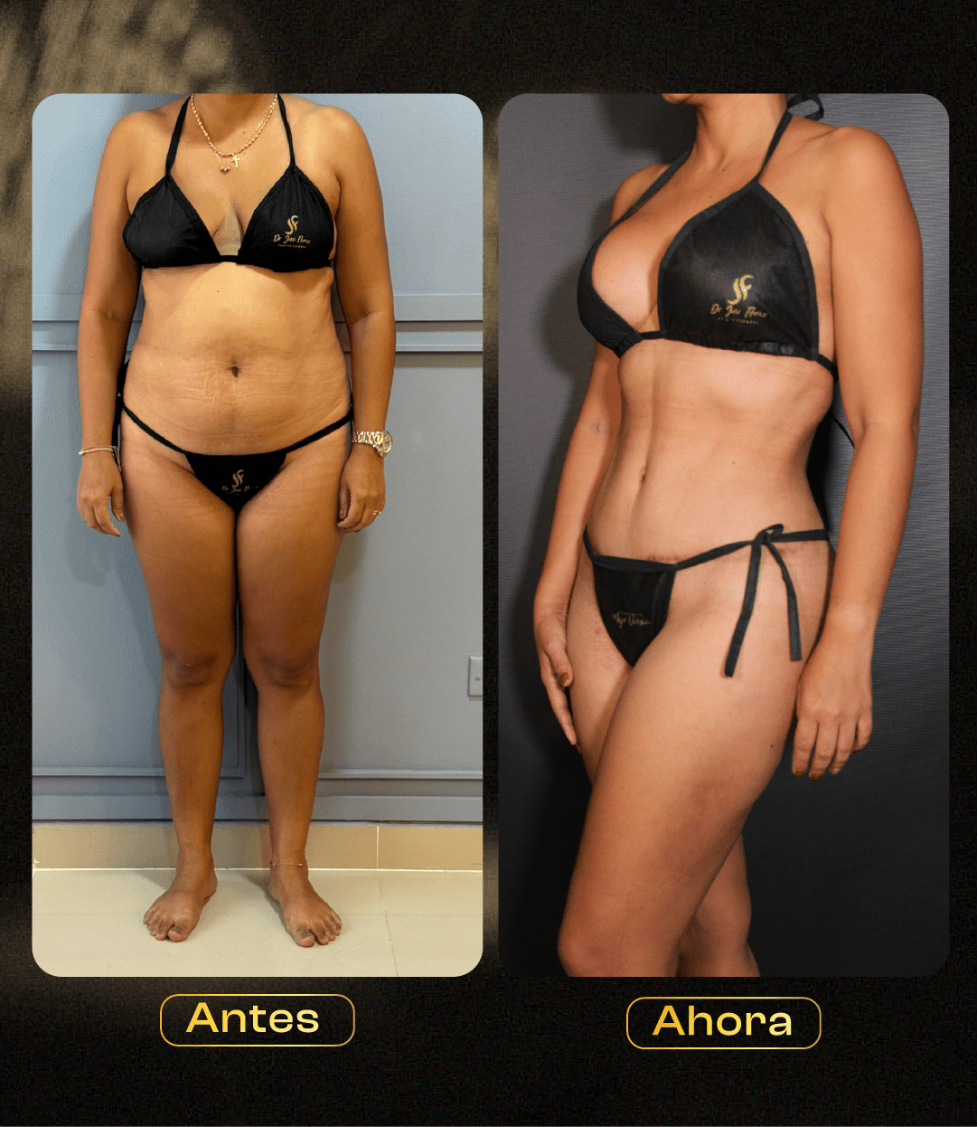 Image hover effect image