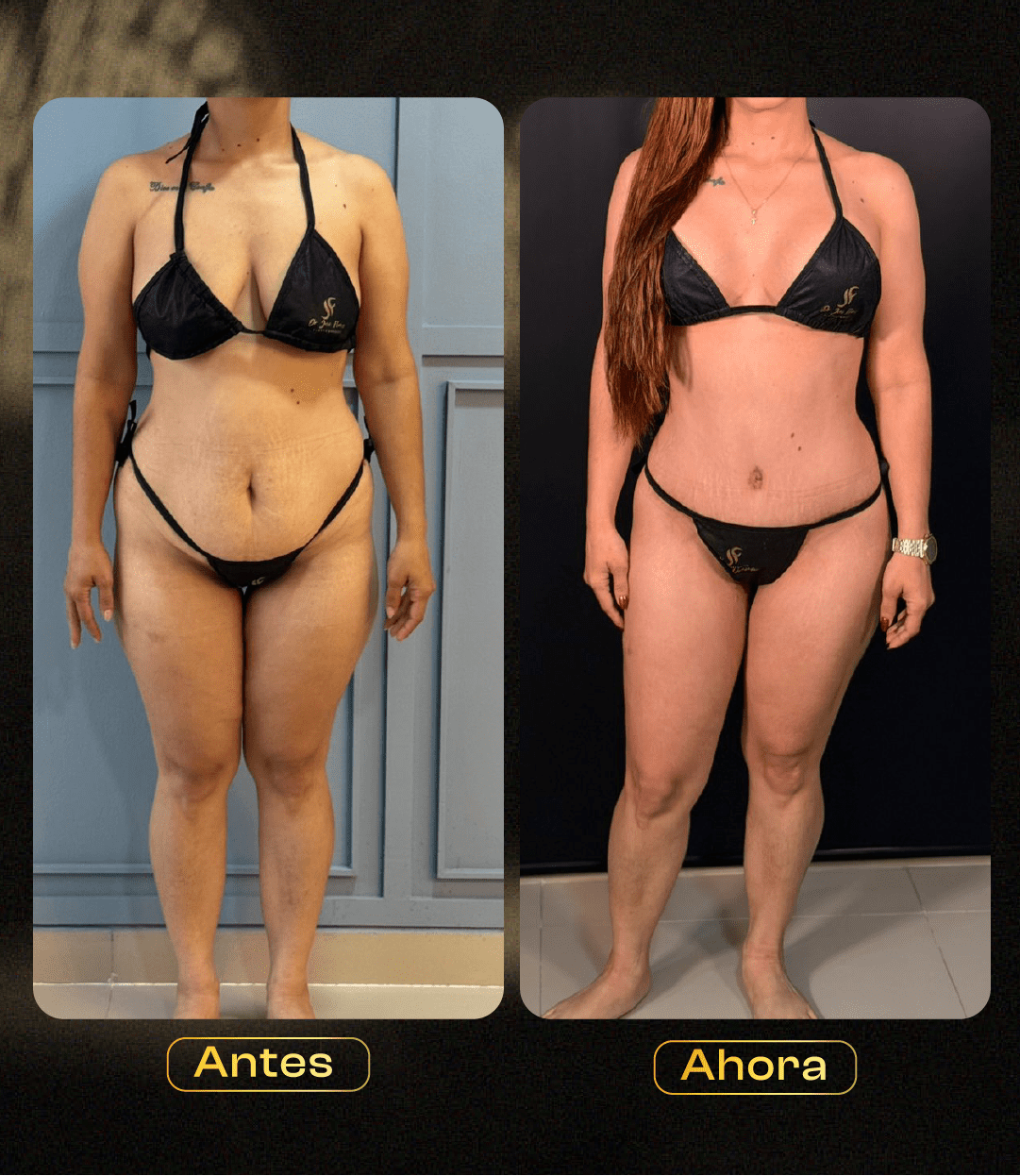 Image hover effect image