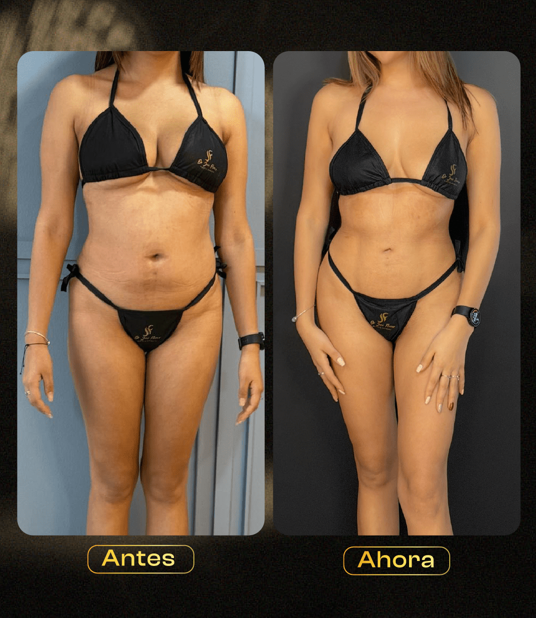 Image hover effect image