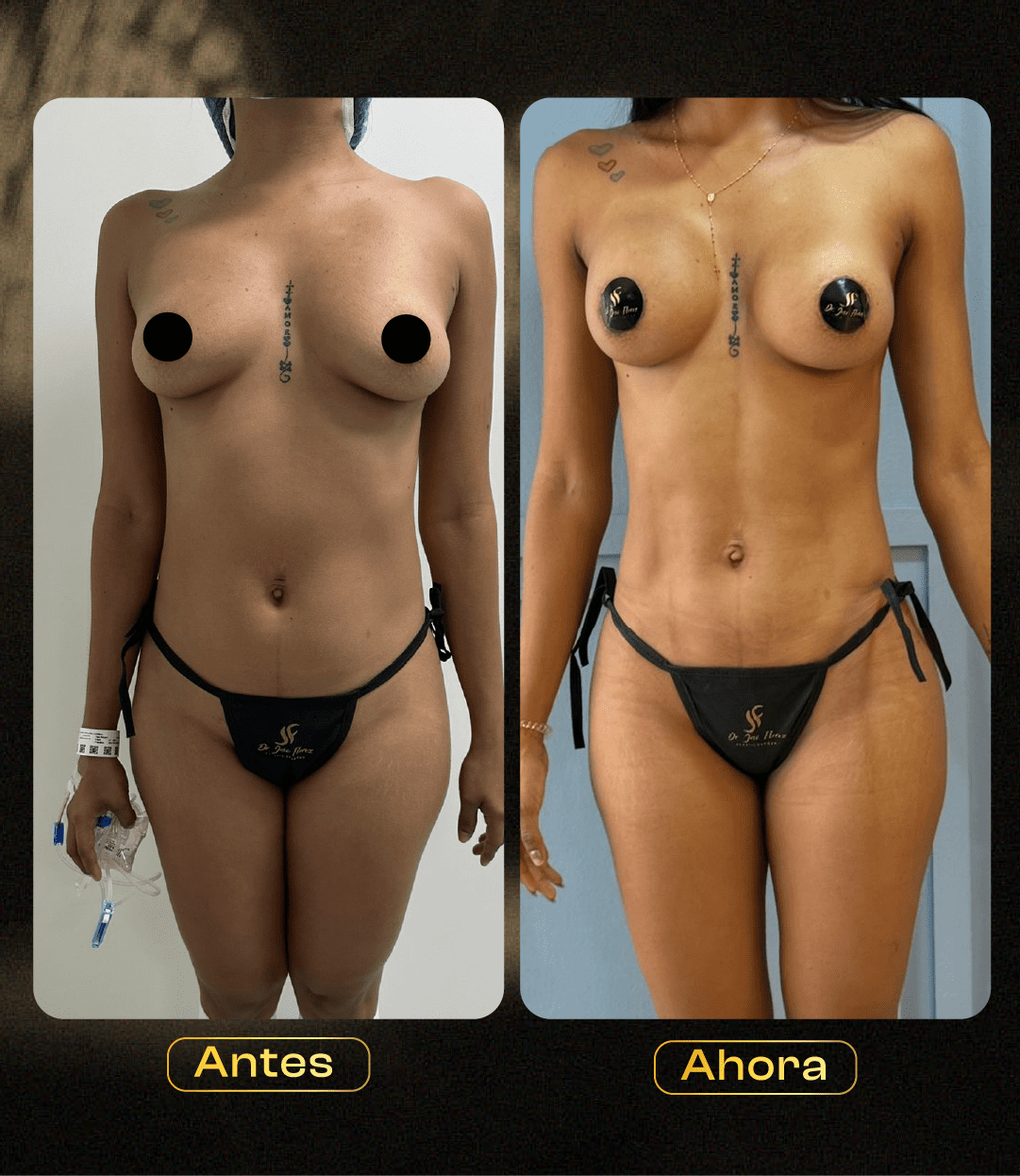 Image hover effect image