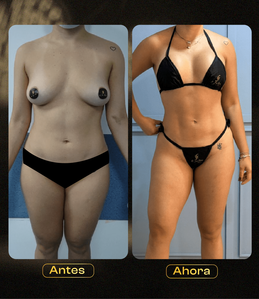 Image hover effect image