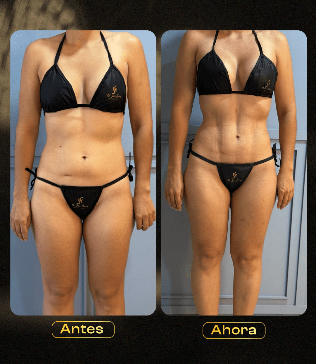 Image hover effect image