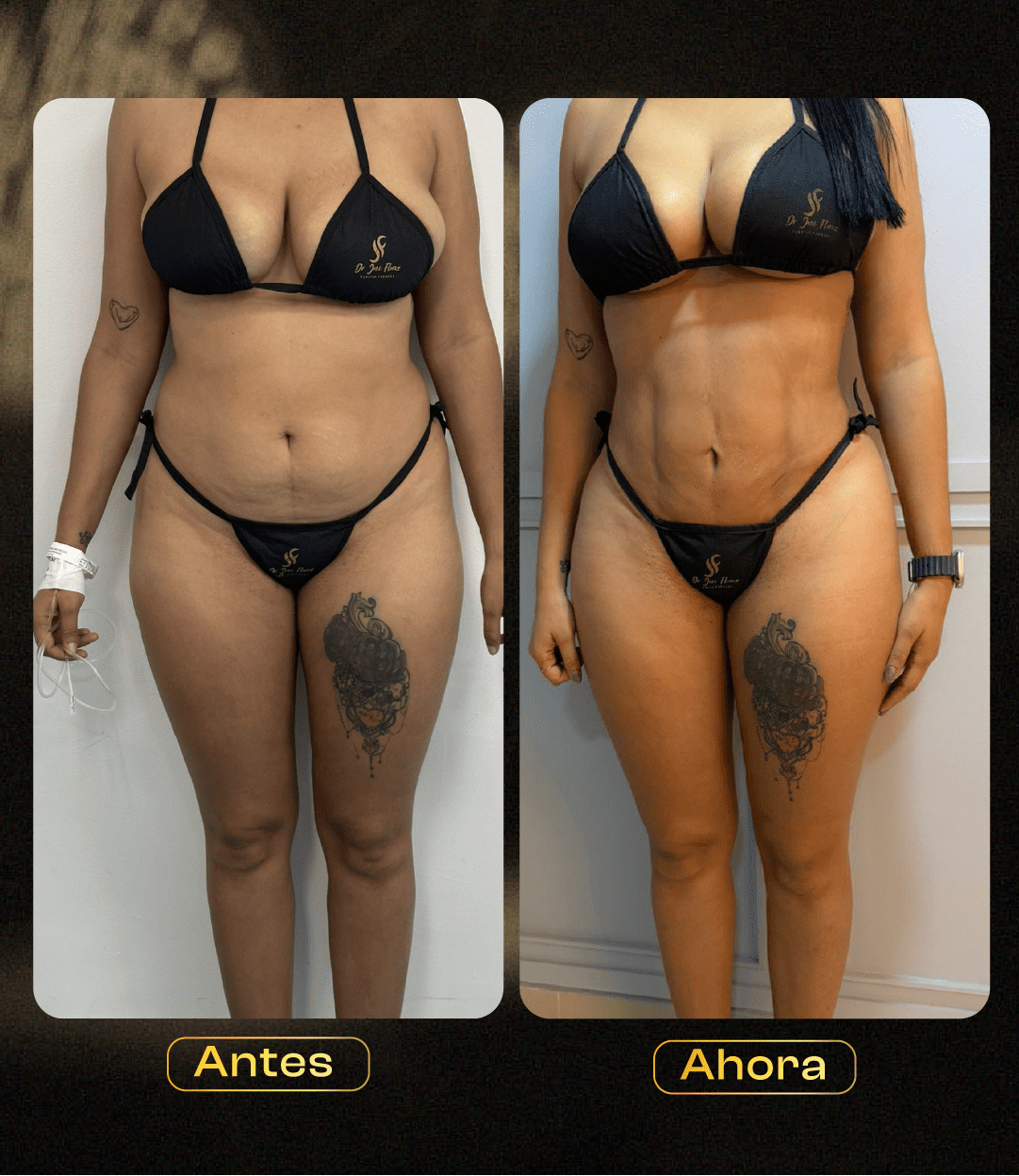 Image hover effect image