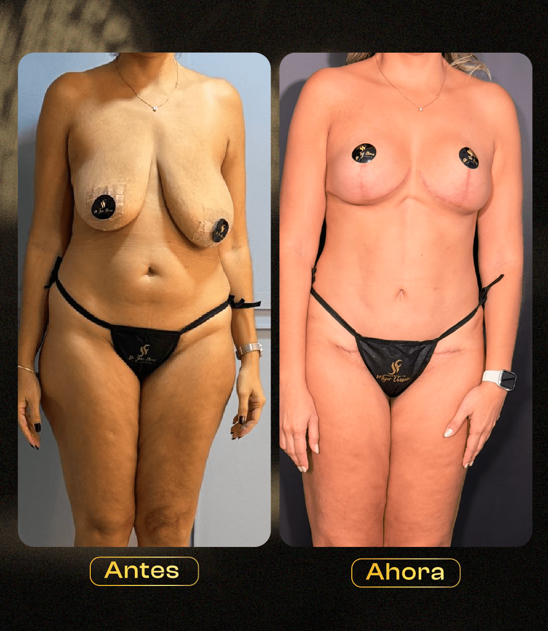 Image hover effect image