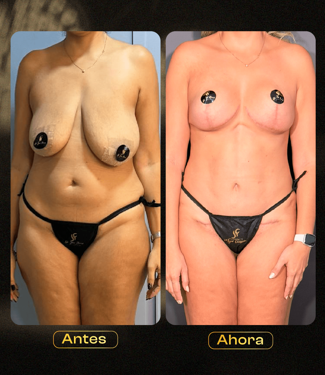 Image hover effect image